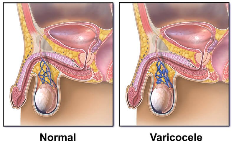 10-signs-you-may-have-kidney-cancer